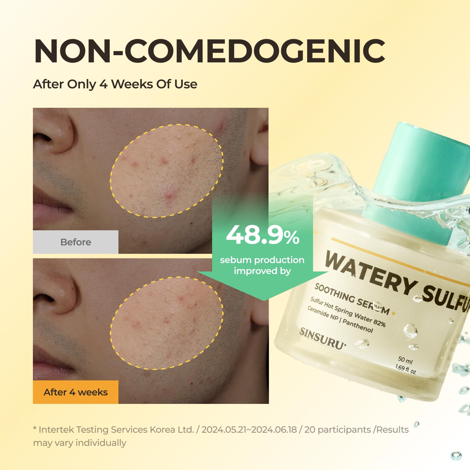 Watery Sulfur Acne Care Duo 1 – Soothing Serum & Cleansing Powder for Acne-Prone Skin | Fragrance-Free, Non-Comedogenic, Gentle Korean Skincare for Sensitive & Oily Skin