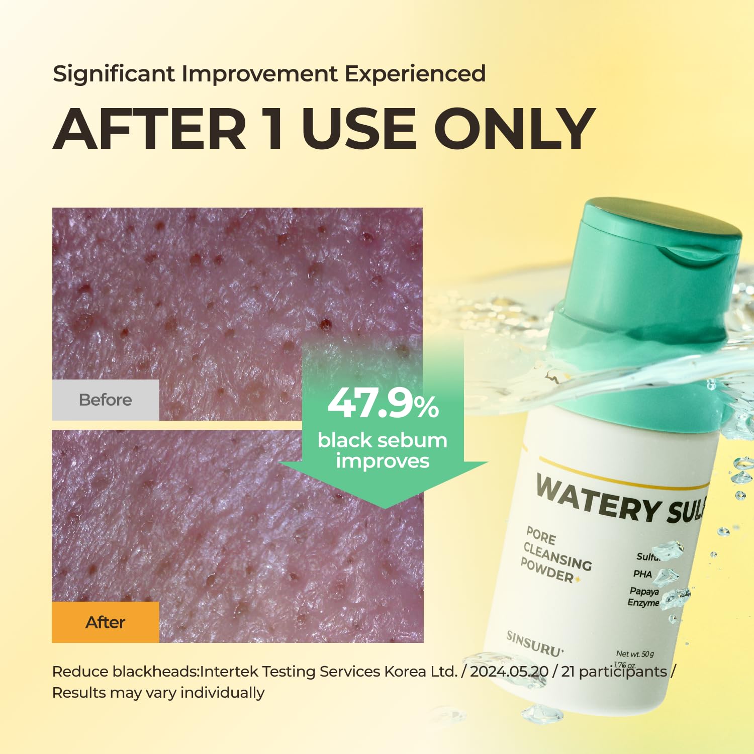 Watery Sulfur Acne Care Duo 1 – Soothing Serum & Cleansing Powder for Acne-Prone Skin | Fragrance-Free, Non-Comedogenic, Gentle Korean Skincare for Sensitive & Oily Skin